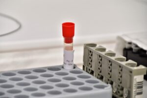 Klinická biochemie a hematologie — fotka 10